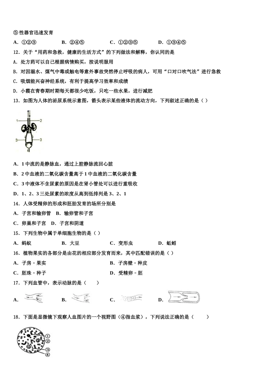 2025届江苏省无锡市七年级生物第二学期期末经典试题含解析_第3页