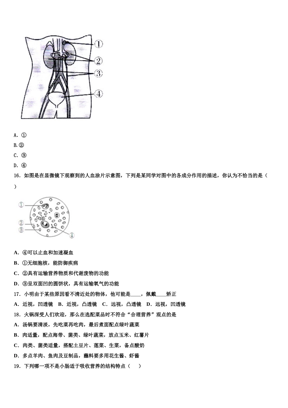 重庆市巴蜀中学2025年七下生物期末监测试题含解析_第3页
